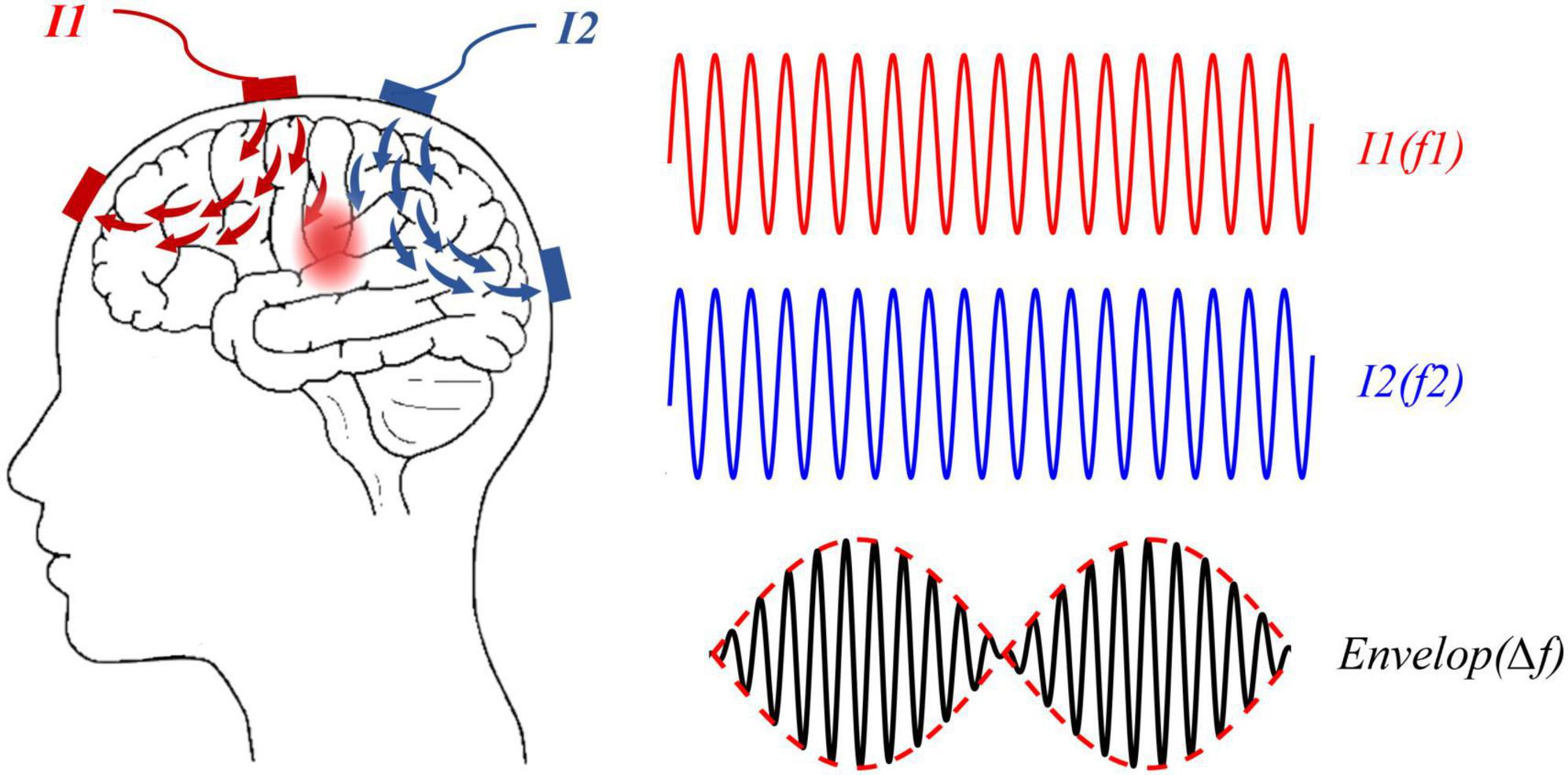 Frontiers | A Novel Non-invasive Brain Stimulation Technique ...